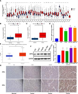 Elevated MPP6 expression correlates with an unfavorable prognosis, angiogenesis and immune evasion in hepatocellular carcinoma